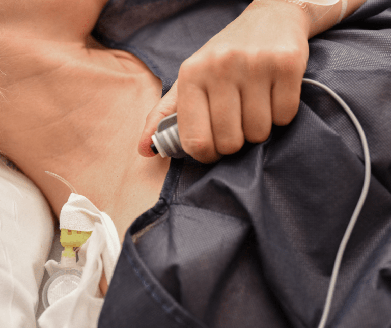 Ventajas de ponerte la epidural en el parto
